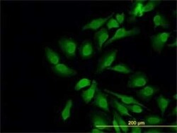 N-WASP Antibody (5F4), Novus Biologicals 0.1 mg | Buy Online | Novus Biologicals | Fisher Scientific