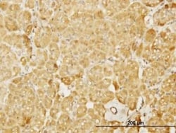 N-WASP Antibody (5F4), Novus Biologicals 0.1 mg | Buy Online | Novus Biologicals | Fisher Scientific