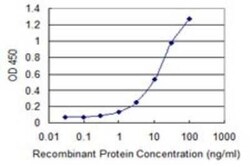 N acetyl transferase 5 Antibody (2C6), Novus Biologicals 0.1 mg | Buy Online | Novus Biologicals | Fisher Scientific
