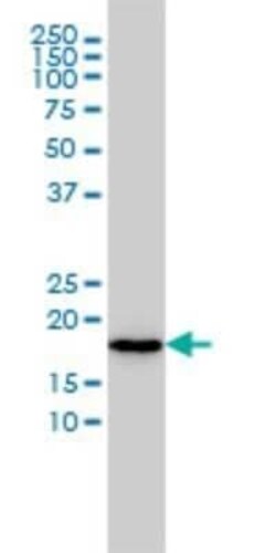 N acetyl transferase 5 Antibody (2C6), Novus Biologicals 0.1 mg | Buy Online | Novus Biologicals | Fisher Scientific