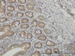N myc interactor Antibody (9B8), Novus Biologicals 0.1 mg | Buy Online | Novus Biologicals | Fisher Scientific