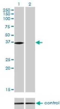 N myc interactor Antibody (9D8), Novus Biologicals 0.1 mg | Buy Online | Novus Biologicals | Fisher Scientific
