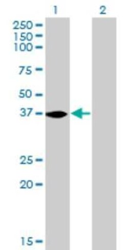 N myc interactor Antibody (9D8), Novus Biologicals 0.1 mg | Buy Online | Novus Biologicals | Fisher Scientific