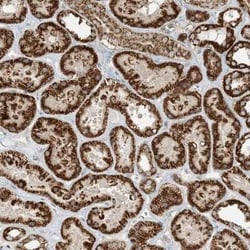 N4BP3 Antibody, Novus Biologicals:Antibodies:Primary Antibodies