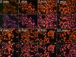 N6-methyladenosine (m6A) Antibody - Azide and BSA Free, Novus Biologicals 100 &mu;g | Buy Online | Novus Biologicals | Fisher Scientific