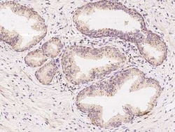 NAA10 Antibody, Novus Biologicals:Antibodies:Primary Antibodies