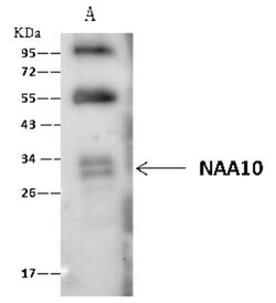 NAA10 Antibody, Novus Biologicals:Antibodies:Primary Antibodies