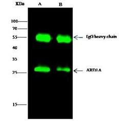 NAA10 Antibody, Novus Biologicals 100 &mu;g; Unconjugated:Antibodies, Polyclonal