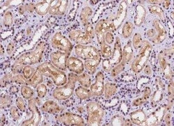 NAC1 Antibody, Novus Biologicals 100 &mu;g, Unconjugated:Antibodies, Polyclonal