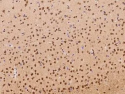 NAC1 Antibody, Novus Biologicals™