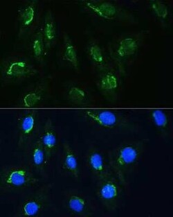 NAG Antibody - BSA Free, Novus Biologicals 0.1 mL, Unconjugated:Antibodies,