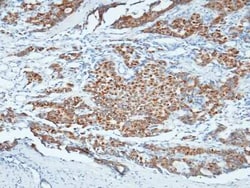 NANOS1 Antibody, Novus Biologicals 50 &mu;g, Unconjugated:Antibodies, Polyclonal