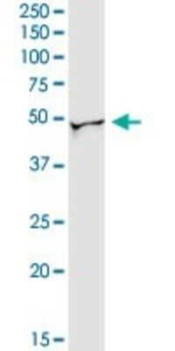 Novus Biologicals NAP1L3 Antibody, Novus Biologicals 0.1 mg | Buy Online | Novus Biologicals&trade; | Fisher Scientific