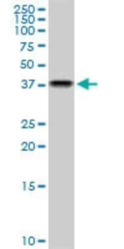 NAPG Antibody (4B5), Novus Biologicals 0.1 mg, Unconjugated:Antibodies,
