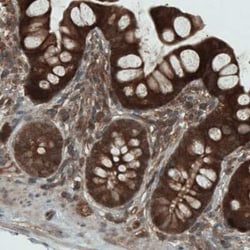 NAPRT1 Antibody (CL0366), Novus Biologicals 25 &mu;L, Unconjugated:Antibodies,