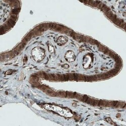 NAPRT1 Antibody (CL0366), Novus Biologicals 25 &mu;L, Unconjugated:Antibodies,