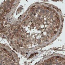 NAPRT1 Antibody (CL0366), Novus Biologicals:Antibodies:Primary Antibodies