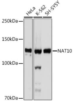 NAT10 Rabbit anti-Human, Mouse, Rat, Clone: 5Z3E5, Novus Biologicals 100