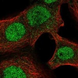 NAT11 Rabbit anti-Human, Polyclonal, Novus Biologicals 100 &mu;g | Buy Online | Novus Biologicals | Fisher Scientific