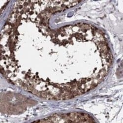 NAT13 Rabbit anti-Human, Polyclonal, Novus Biologicals 100 &mu;g; Unconjugated:Antibodies,