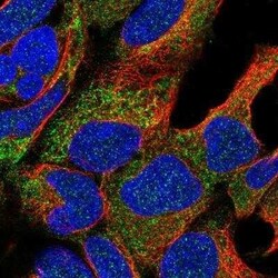 NAT8L Antibody, Novus Biologicals 25 &mu;L | Buy Online | Novus Biologicals | Fisher Scientific