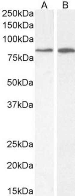 PLC-delta 3 Antibody, Novus Biologicals 0.1 mg; Unconjugated:Antibodies,