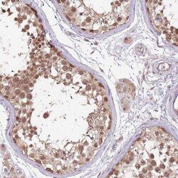 NBPF4 Antibody, Novus Biologicals:Antibodies:Primary Antibodies