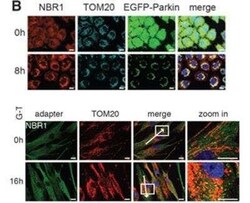 NBR1 Antibody (6B11), Novus Biologicals 0.1 mg | Buy Online | Novus Biologicals | Fisher Scientific