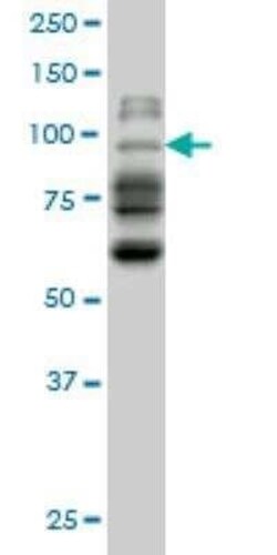 NBR1 Antibody (6B11), Novus Biologicals 0.1 mg | Buy Online | Novus Biologicals | Fisher Scientific