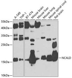 NCALD Antibody - BSA Free, Novus Biologicals 0.1 mL; Unconjugated:Antibodies,