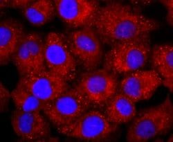 NCAM-1/CD56 Antibody (JF1021), Novus Biologicals 100&mu;L:Antibodies, Monoclonal