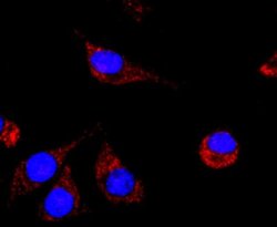 NCAM-1/CD56 Antibody (JF1021), Novus Biologicals 100&mu;L:Antibodies, Monoclonal