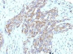 NCAM-1/CD56 Antibody (123C3.D5 + 123A8) - Azide and BSA Free, Novus Biologicals 0.1 mg | Buy Online | Novus Biologicals | Fisher Scientific