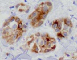 NCAM-1/CD56 Antibody (123C3.D5), Novus Biologicals 0.1mg; Unlabeled:Antibodies,