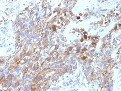 NCAM-1/CD56 Antibody (NCAM1/795), Novus Biologicals 0.1mg; Unlabeled:Antibodies,