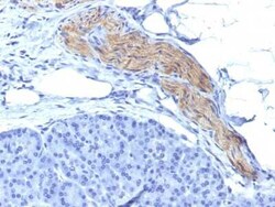NCAM-1/CD56 Antibody (NCAM1/795), Novus Biologicals 0.1mg; Unlabeled:Antibodies,
