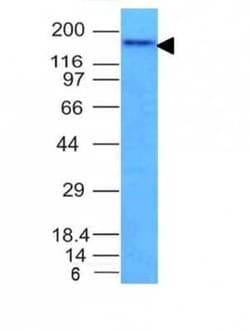 NCAM-1/CD56 Antibody (NCAM1/795), Novus Biologicals 0.1mg; Unlabeled:Antibodies,