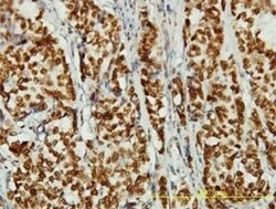 NCAPD3 Antibody (1D5), Novus Biologicals 0.1 mg | Buy Online | Novus Biologicals | Fisher Scientific