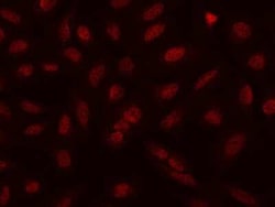 NCAPH Antibody, Novus Biologicals:Antibodies:Primary Antibodies