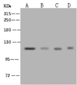 NCAPH Antibody, Novus Biologicals:Antibodies:Primary Antibodies
