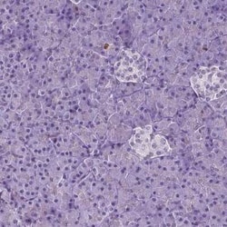 NCAPH2 Antibody, Novus Biologicals 25 &mu;L, Unconjugated:Antibodies, Polyclonal
