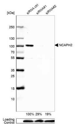 NCAPH2 Antibody, Novus Biologicals 25 &mu;L, Unconjugated:Antibodies, Polyclonal