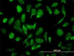 NCOA4 Antibody (1F11), Novus Biologicals 0.1 mg | Buy Online | Novus Biologicals | Fisher Scientific