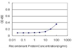 NCOA5 Antibody (1E9), Novus Biologicals 0.1 mg | Buy Online | Novus Biologicals | Fisher Scientific