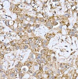 ND6 Antibody - Azide and BSA Free, Novus Biologicals:Antibodies:Primary