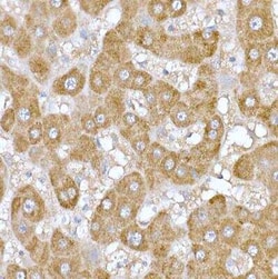 ND6 Antibody - Azide and BSA Free, Novus Biologicals:Antibodies:Primary