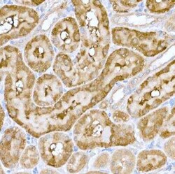 ND6 Antibody - Azide and BSA Free, Novus Biologicals:Antibodies:Primary