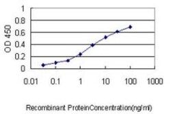 NDC80 Antibody (1A10), Novus Biologicals 0.1 mg | Buy Online | Novus Biologicals | Fisher Scientific