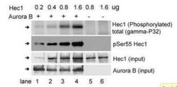 NDC80, p Ser55 Antibody, Novus Biologicals 100 &mu;g | Buy Online | Novus Biologicals | Fisher Scientific
