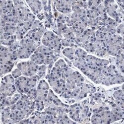 NDP52 Antibody, Novus Biologicals 25 &mu;L; Unconjugated:Antibodies, Polyclonal